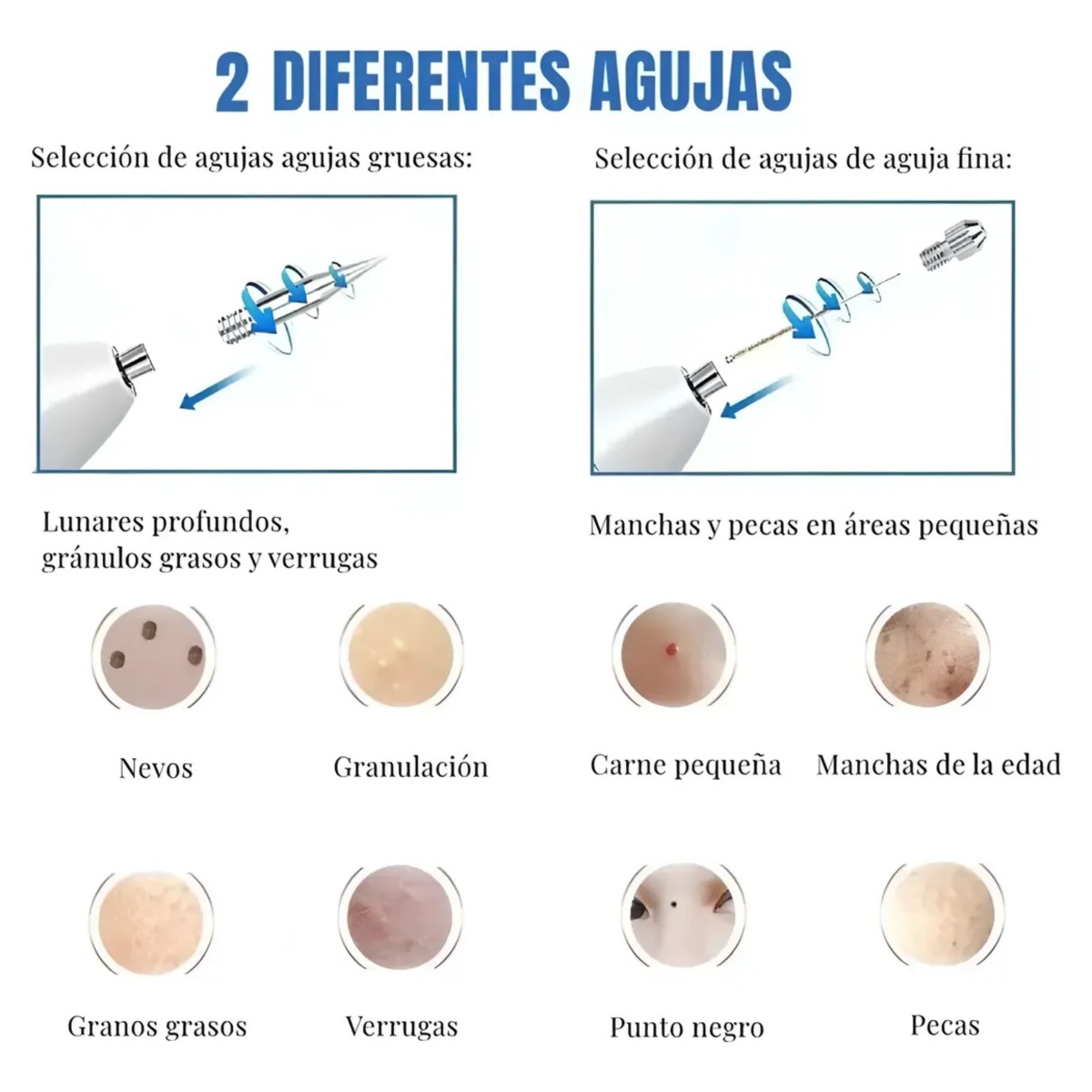 Pluma Quita Verrugas Pecas Cauterizador Remuve Manchas Luz image number null
