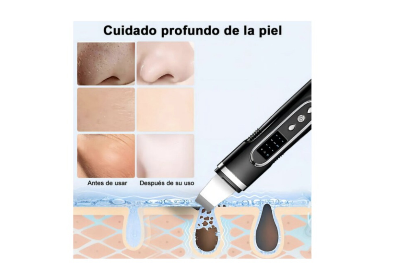 Limpiador Facial Ultras&oacute;nico Negro Carga Usb 4 Modos Profundos Modelo Negro image number null