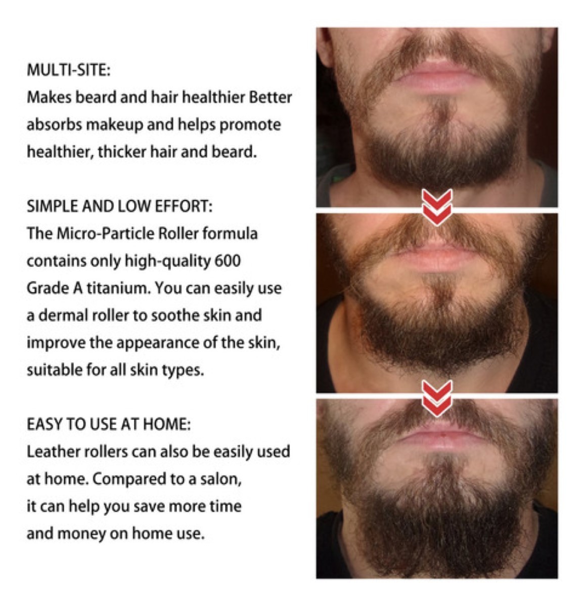 Derma Roller 0.5 Mm Para Barba Y Facial Cabello negro image number null