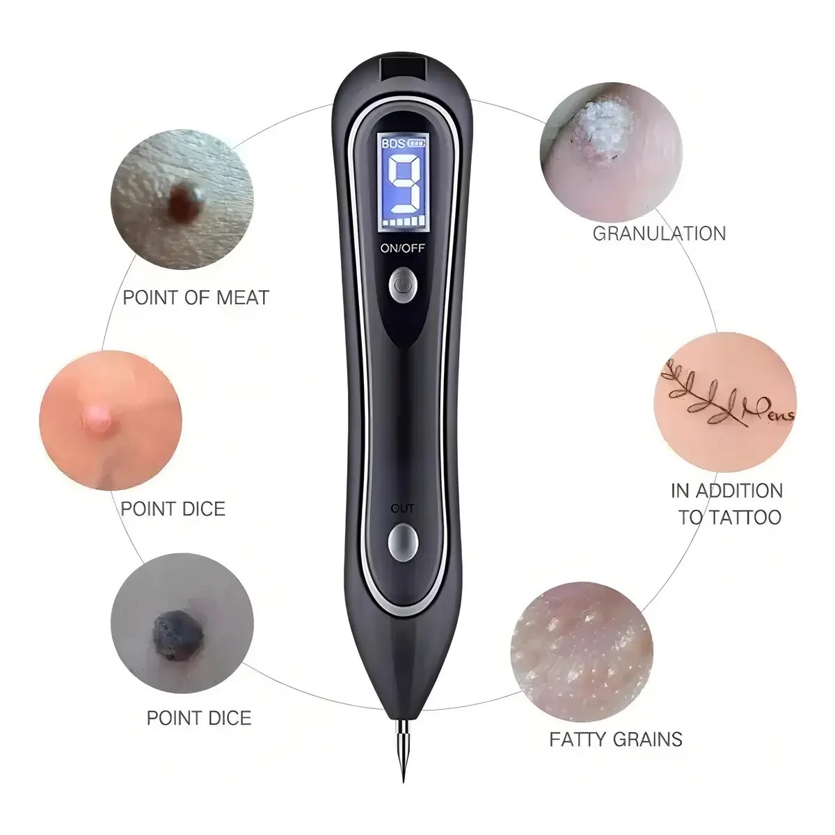 Cauterizador Recargable 25 con Display Elimina Verrugas y Pecas 9 Niveles LED image number null