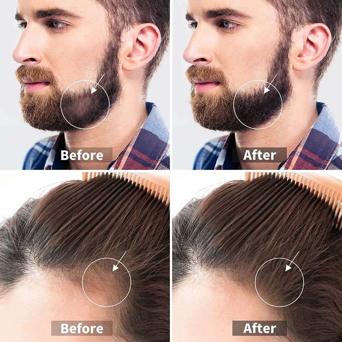Rodillo Para Barba 0.5 Mm image number null