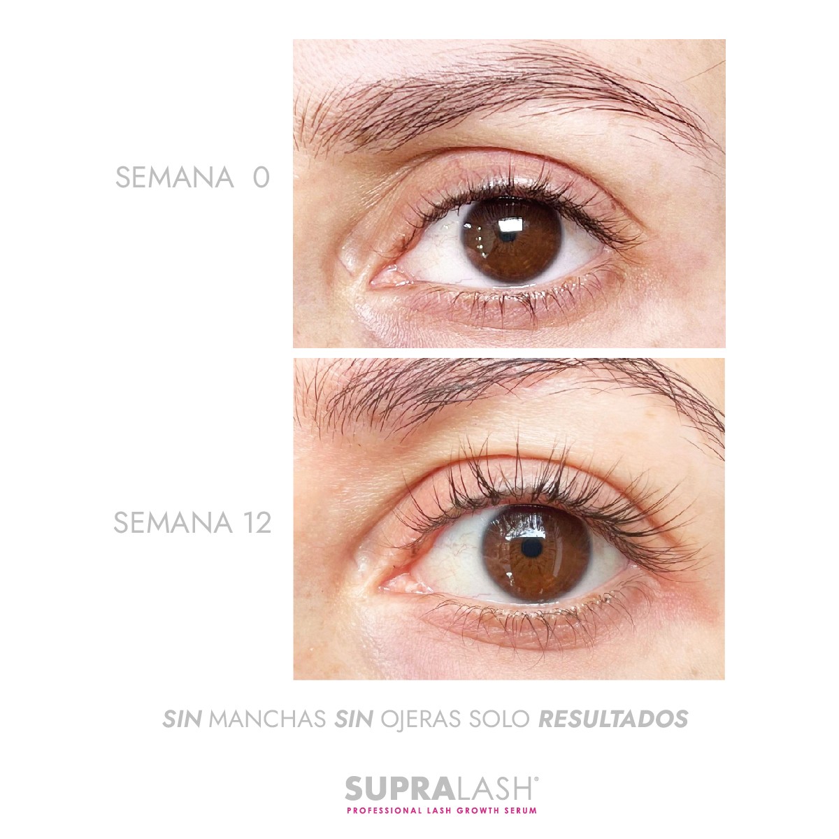 SUPRALASH serum pesta&ntilde;as crecimiento 2.9 ml alargador fortalecedor cl&iacute;nico image number null