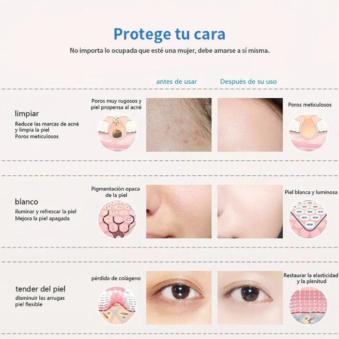 Mascara Facial LED 7 Colores para Cuidado Facial &middot; Terapia Lum&iacute;nica &middot; Antiedad &middot; Reafirmante &middot; Control Remoto Incluido image number null