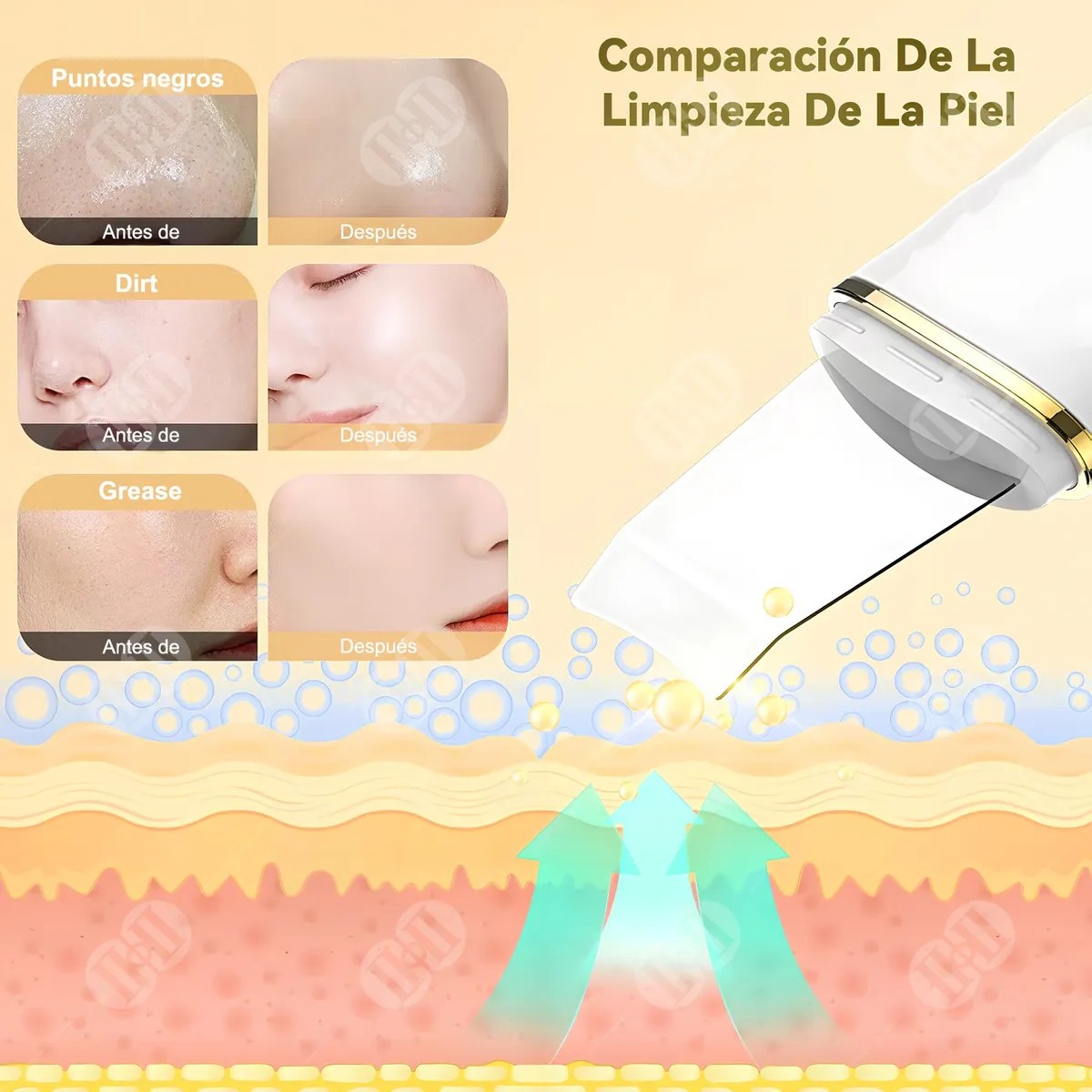 Limpiador Ultras&oacute;nico Con 4 Modos Eliminaci&oacute;n De Puntos Negros Y Limpieza. image number null