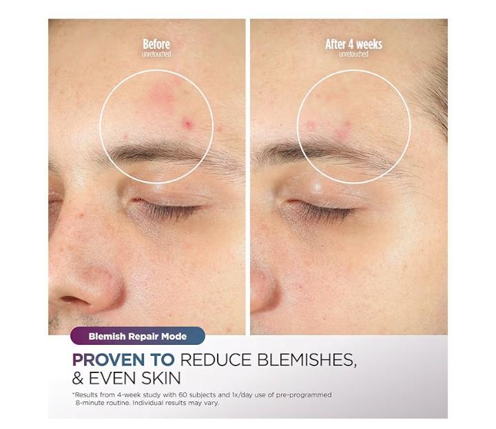 Mascarilla facial led antiedad cuidado de la piel image number null